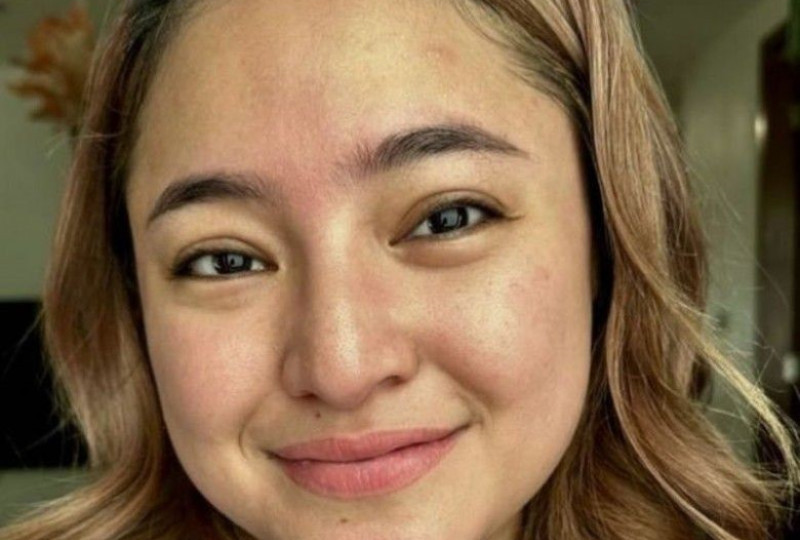 Kontroversi Marshanda: Netizen Bully Setelah Posting Wajah Tanpa Makeup